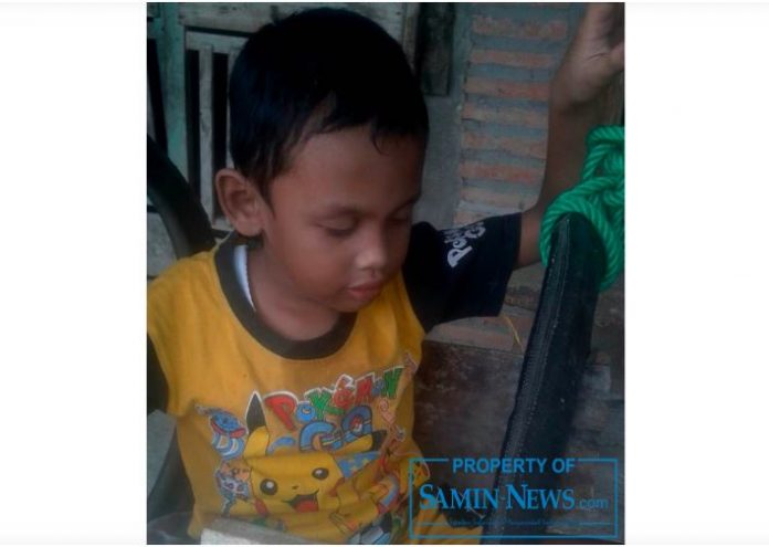 Arif Arifin dengan penderitaan yang menderanya sejak dilahirkan hingga sekarang.